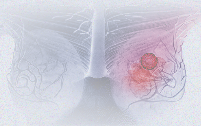 國際婦女節(jié) | 關注乳腺癌 微創(chuàng)介入讓美麗繼續(xù)，「乳」愿以償正成為現(xiàn)實