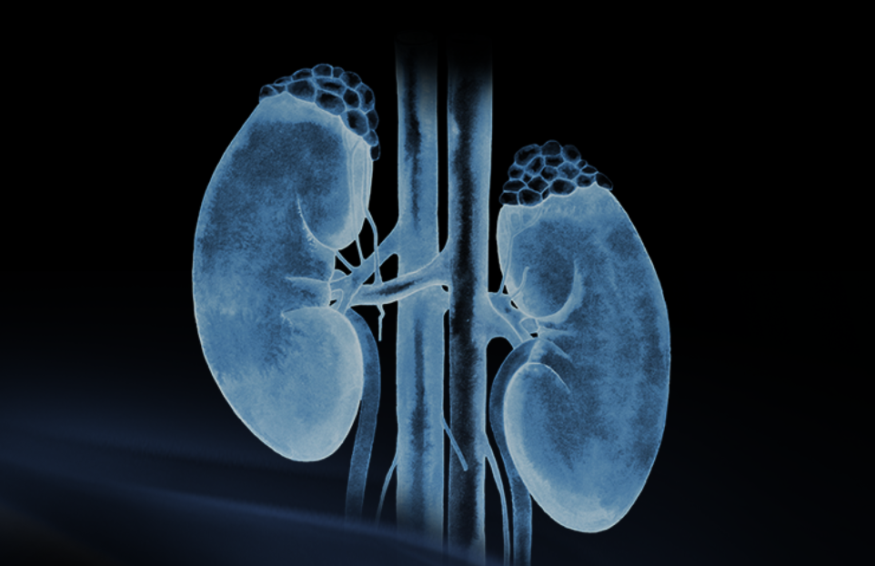 世界腎臟日 | 相得「腎」歡，融有術、精準適形