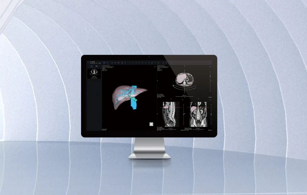 北京市首款！海杰亞醫(yī)療自主研發(fā)的AI+肝臟CT影像處理軟件獲批上市！